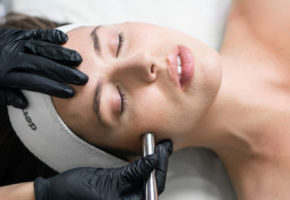 Tretman lica microneedeling u Beauty & Health Alpha et Omega
