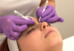 Osjetite čari dermatološkog tretmana za pomlađivanje kože