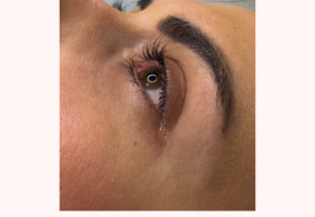 10 bodywrapping terapija (trbuh, leđa) u I’M Beauty Studiu za 1 osobu